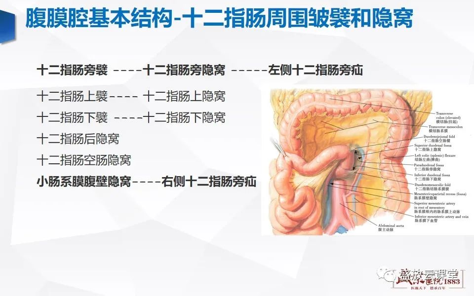 影像PPT - 【PPT】先天性腹内疝的影像诊断思路-12