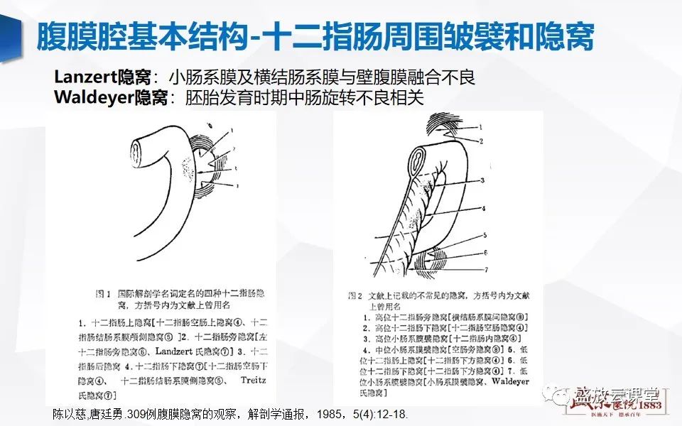 影像PPT - 【PPT】先天性腹内疝的影像诊断思路-13