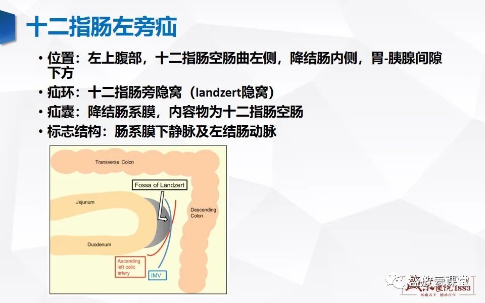影像PPT - 【PPT】先天性腹内疝的影像诊断思路-21