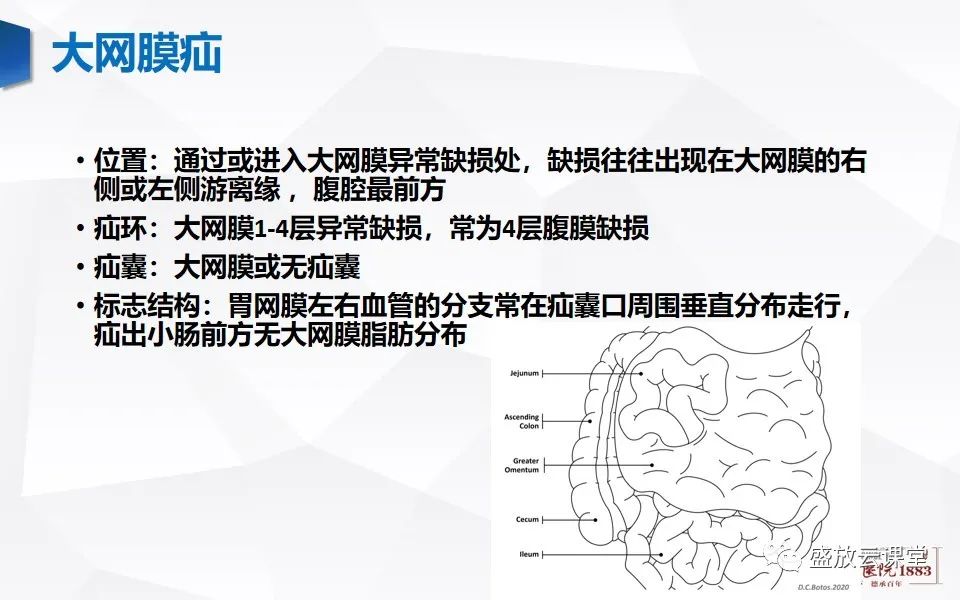 影像PPT - 【PPT】先天性腹内疝的影像诊断思路-41