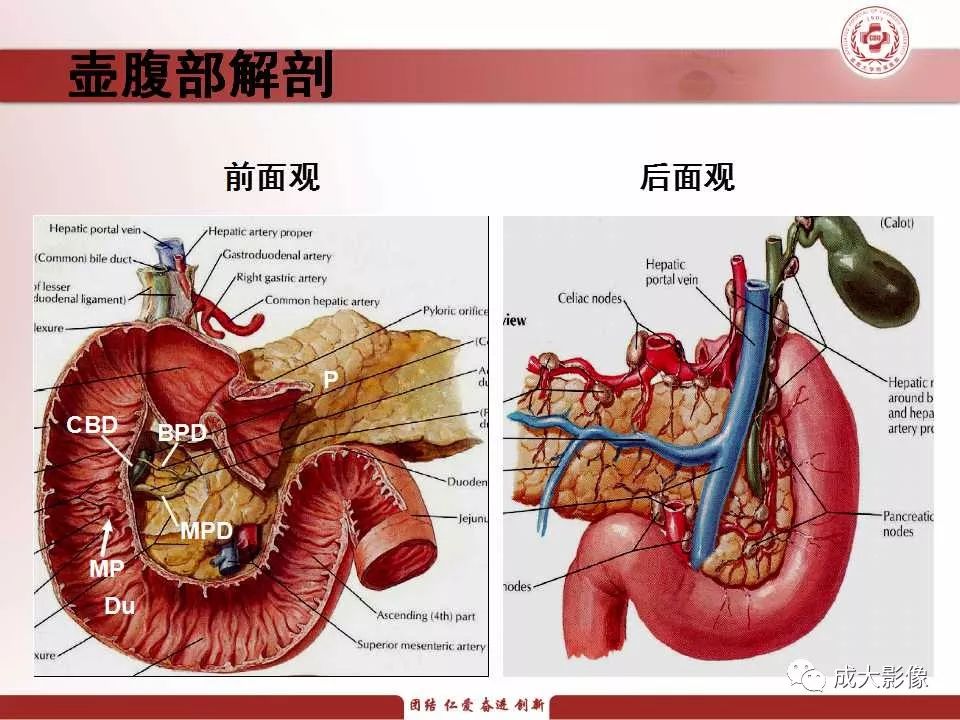 影像PPT - 【PPT】壶腹部周围癌的鉴别-2