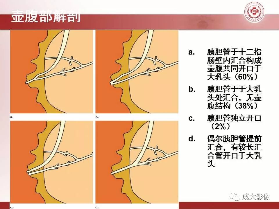 影像PPT - 【PPT】壶腹部周围癌的鉴别-3