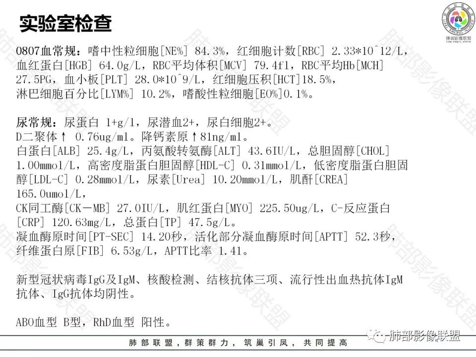 影像PPT - 【病例】钩端螺旋体病弥漫肺出血1例CT影像-4 影像PPT - 【病例】钩端螺旋体病弥漫肺出血1例CT影像-4