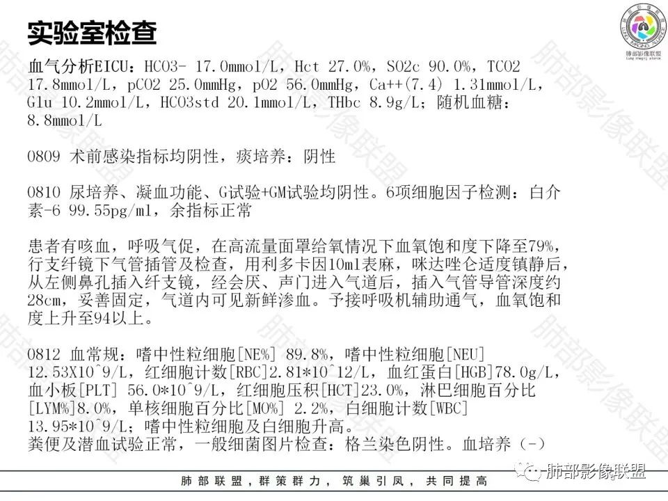 影像PPT - 【病例】钩端螺旋体病弥漫肺出血1例CT影像-5 影像PPT - 【病例】钩端螺旋体病弥漫肺出血1例CT影像-5