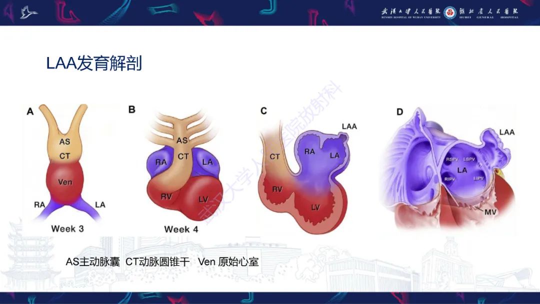 影像PPT - 【PPT】经导管左心耳封堵术CT评估-3