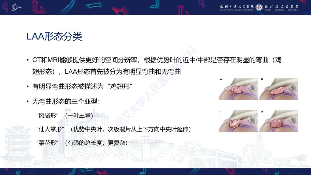 影像PPT - 【PPT】经导管左心耳封堵术CT评估-6