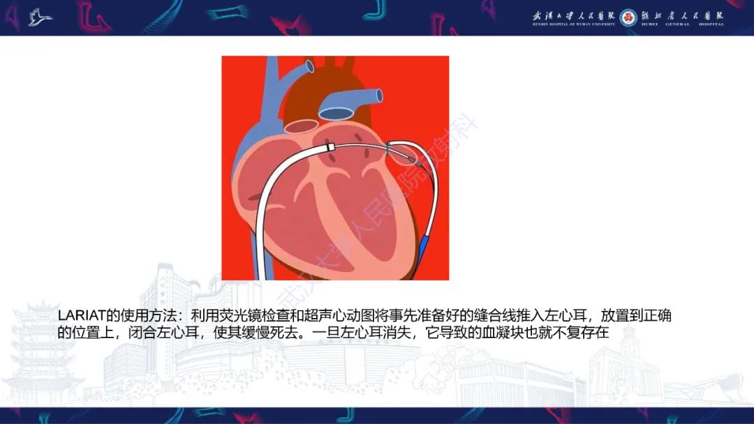 影像PPT - 【PPT】经导管左心耳封堵术CT评估-13