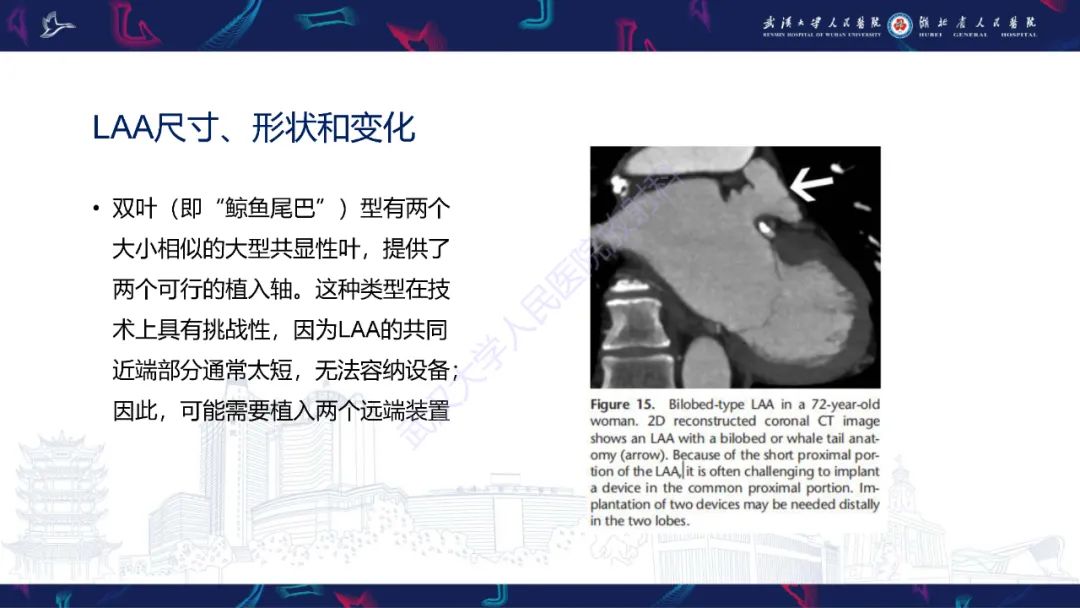 影像PPT - 【PPT】经导管左心耳封堵术CT评估-35