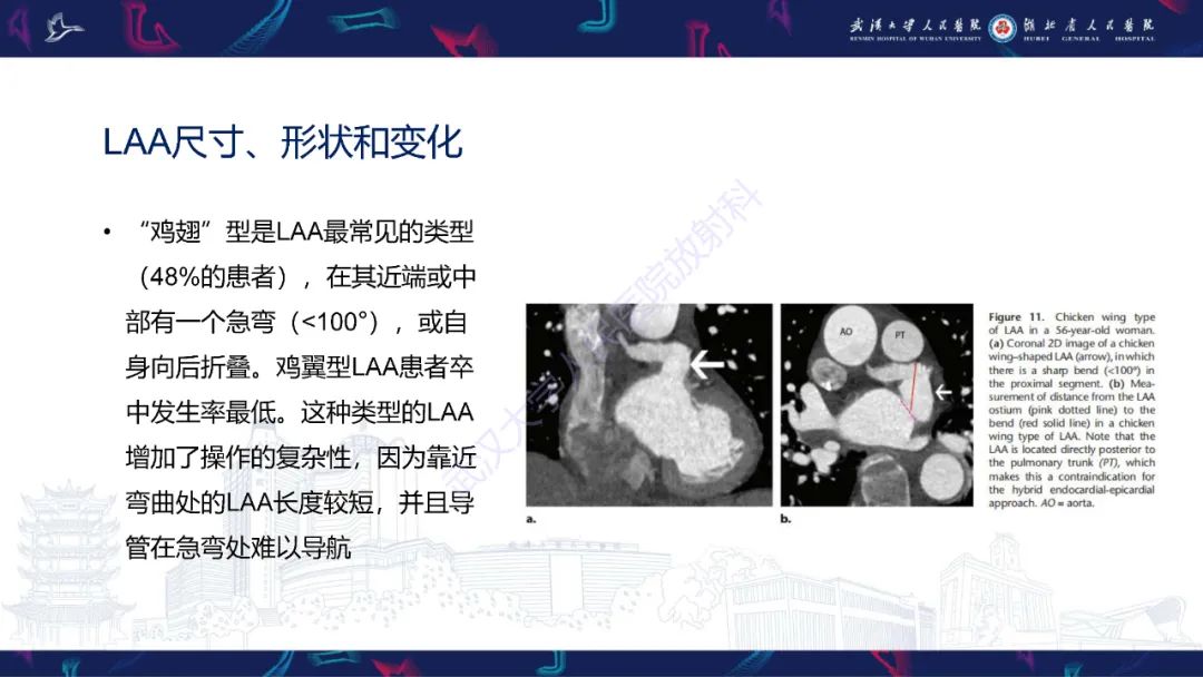 影像PPT - 【PPT】经导管左心耳封堵术CT评估-31