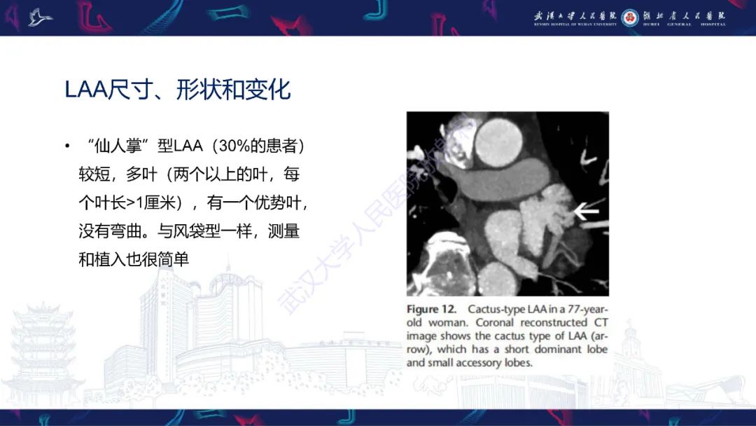 影像PPT - 【PPT】经导管左心耳封堵术CT评估-32