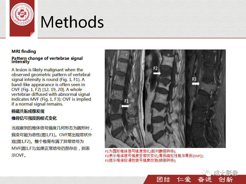 影像PPT - 【PPT】一种基于MRI和CT的新型评分系统用于区分中国患者骨质疏松性椎体骨折和恶性椎体骨折-9