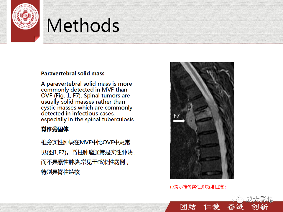 影像PPT - 【PPT】一种基于MRI和CT的新型评分系统用于区分中国患者骨质疏松性椎体骨折和恶性椎体骨折-11