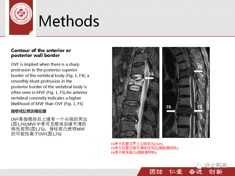 影像PPT - 【PPT】一种基于MRI和CT的新型评分系统用于区分中国患者骨质疏松性椎体骨折和恶性椎体骨折-10