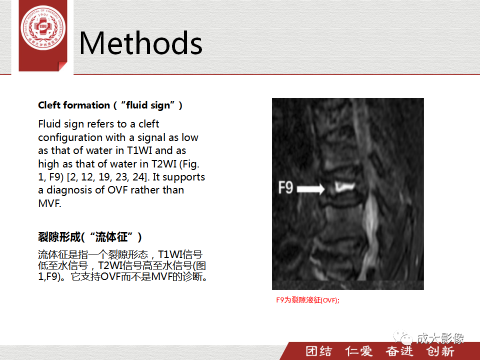 影像PPT - 【PPT】一种基于MRI和CT的新型评分系统用于区分中国患者骨质疏松性椎体骨折和恶性椎体骨折-12