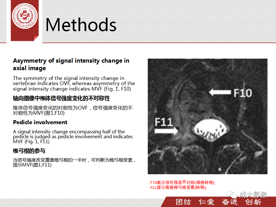 影像PPT - 【PPT】一种基于MRI和CT的新型评分系统用于区分中国患者骨质疏松性椎体骨折和恶性椎体骨折-13