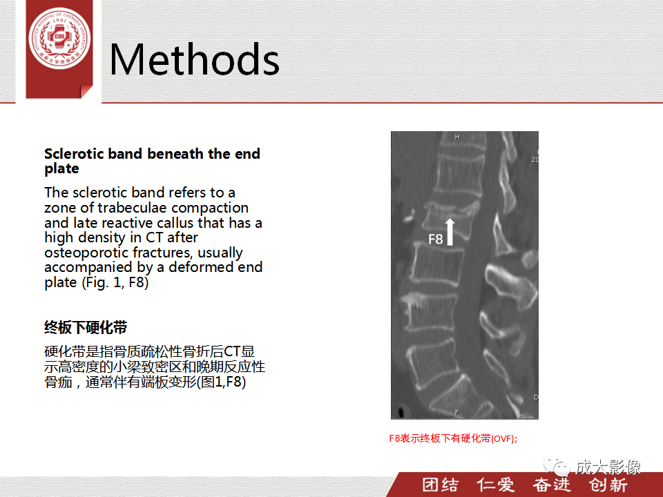 影像PPT - 【PPT】一种基于MRI和CT的新型评分系统用于区分中国患者骨质疏松性椎体骨折和恶性椎体骨折-15