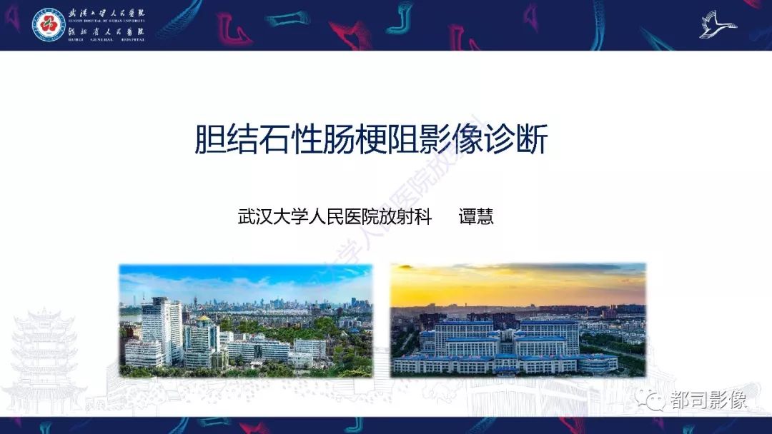 影像PPT - 【PPT】胆结石性肠梗阻影像诊断-1