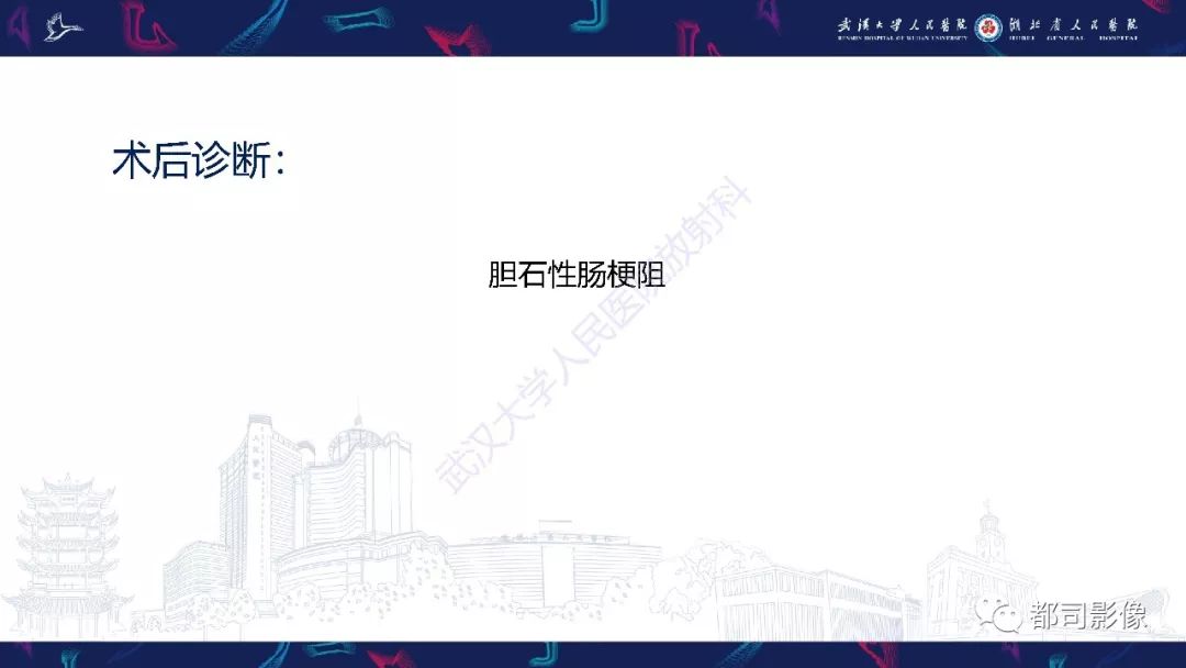 影像PPT - 【PPT】胆结石性肠梗阻影像诊断-5