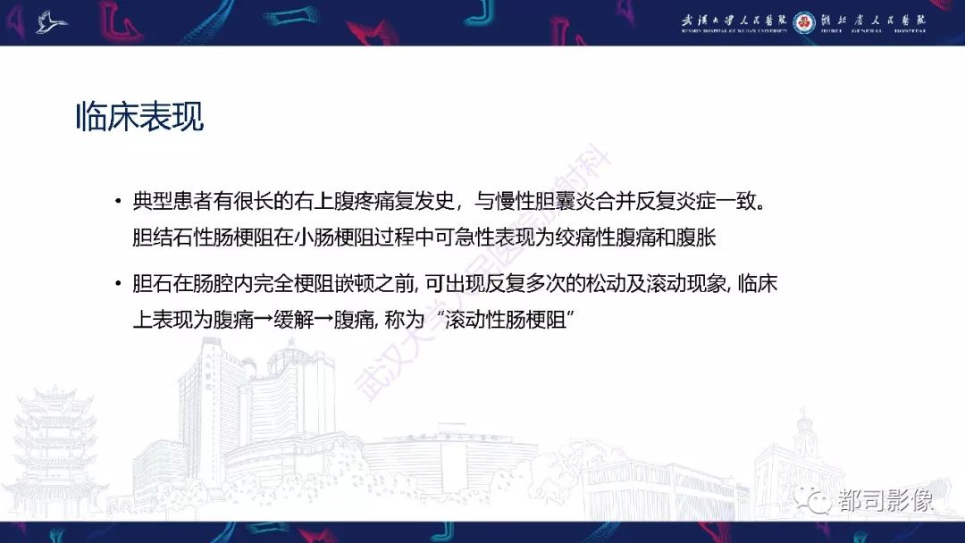 影像PPT - 【PPT】胆结石性肠梗阻影像诊断-8