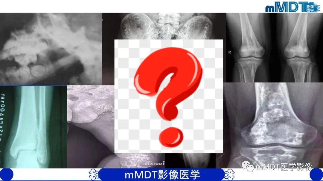 影像PPT - 【PPT】弥漫性骨密度增高影像学浅析-2