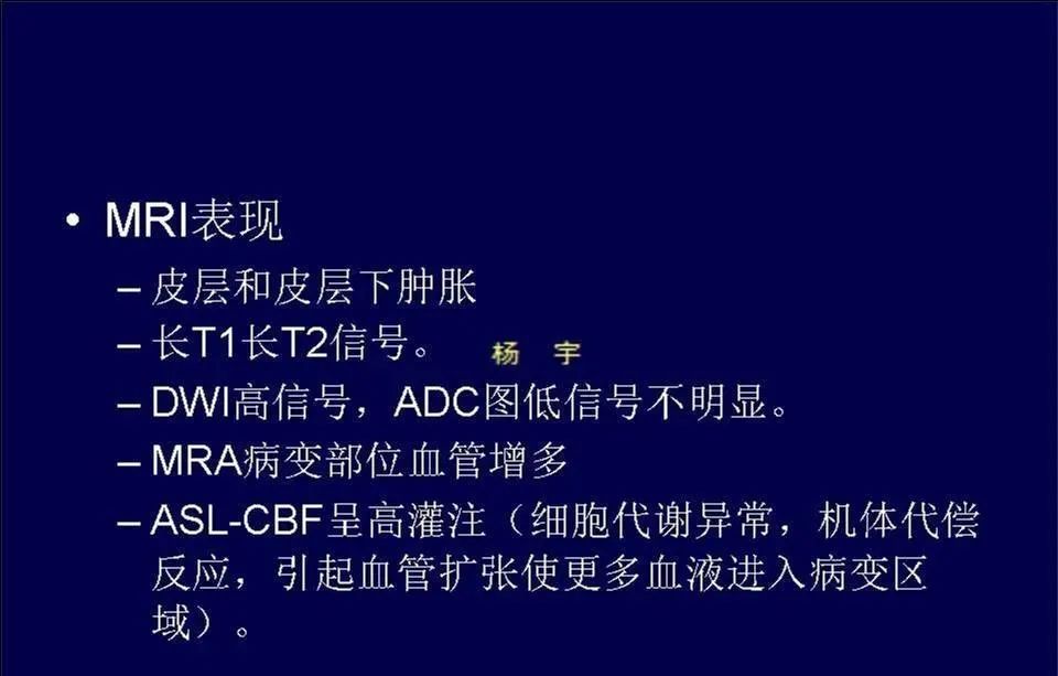 影像PPT - 【PPT】脑皮层病变的MRI表现-16