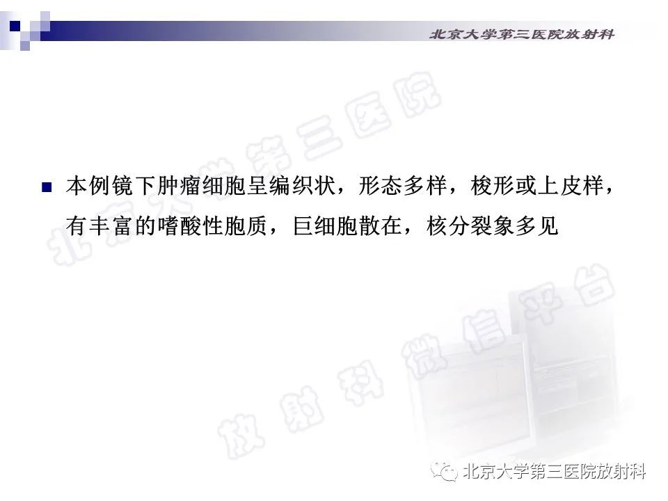 影像PPT - 【PPT】心脏原发性未分化多形性肉瘤-19