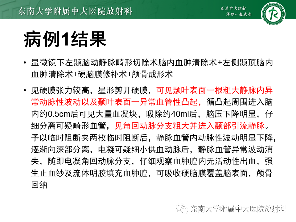 影像PPT - 【PPT】高流量脑血管畸形-3 影像PPT - 【PPT】高流量脑血管畸形-3