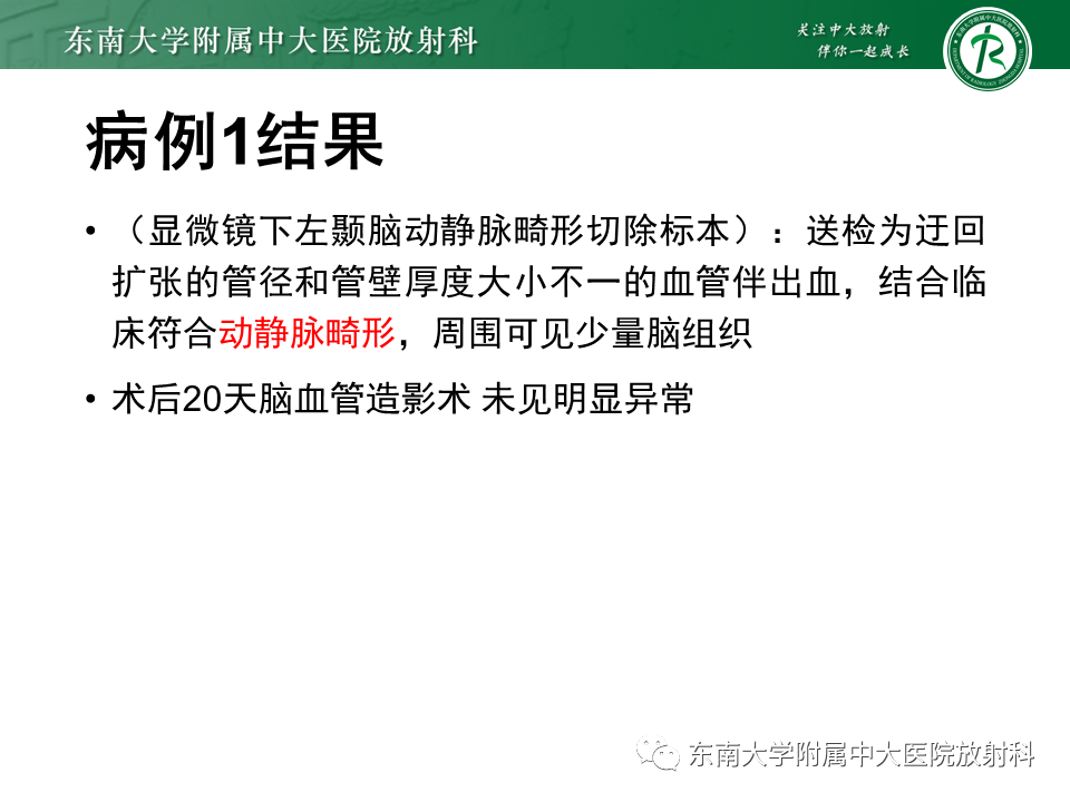 影像PPT - 【PPT】高流量脑血管畸形-4 影像PPT - 【PPT】高流量脑血管畸形-4