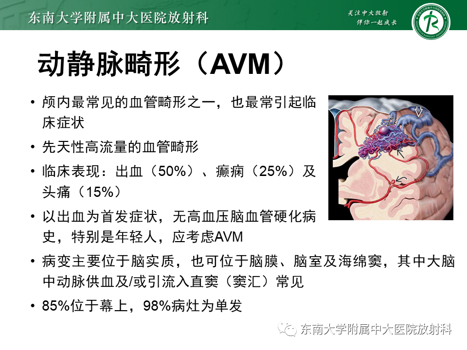 影像PPT - 【PPT】高流量脑血管畸形-8 影像PPT - 【PPT】高流量脑血管畸形-8