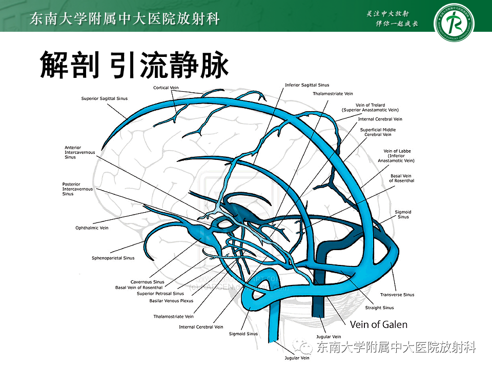 影像PPT - 【PPT】高流量脑血管畸形-25 影像PPT - 【PPT】高流量脑血管畸形-25