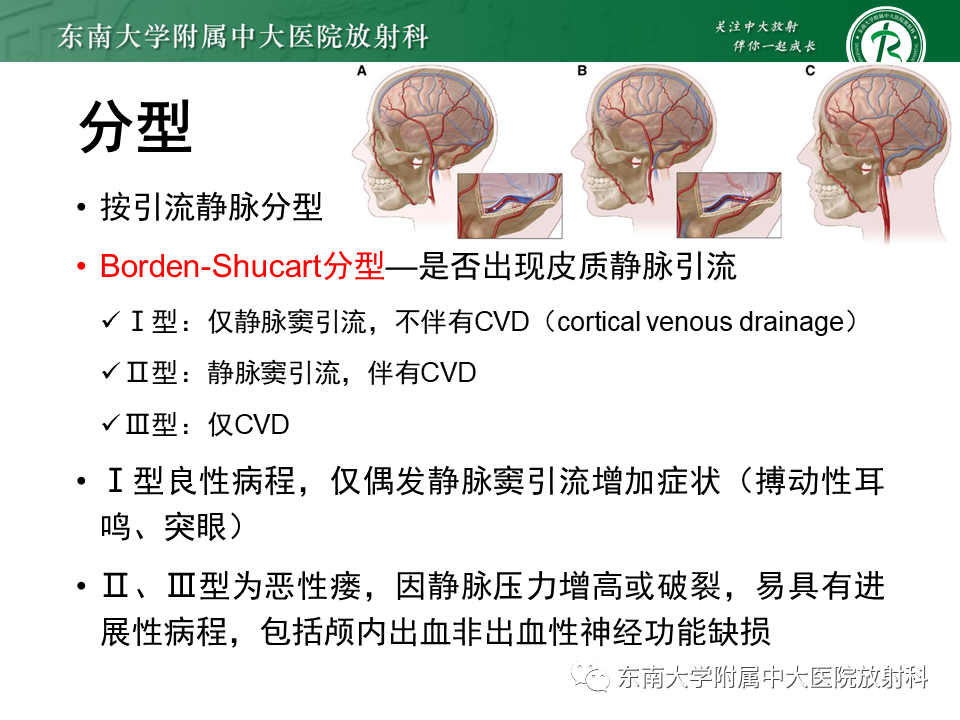 影像PPT - 【PPT】高流量脑血管畸形-27 影像PPT - 【PPT】高流量脑血管畸形-27