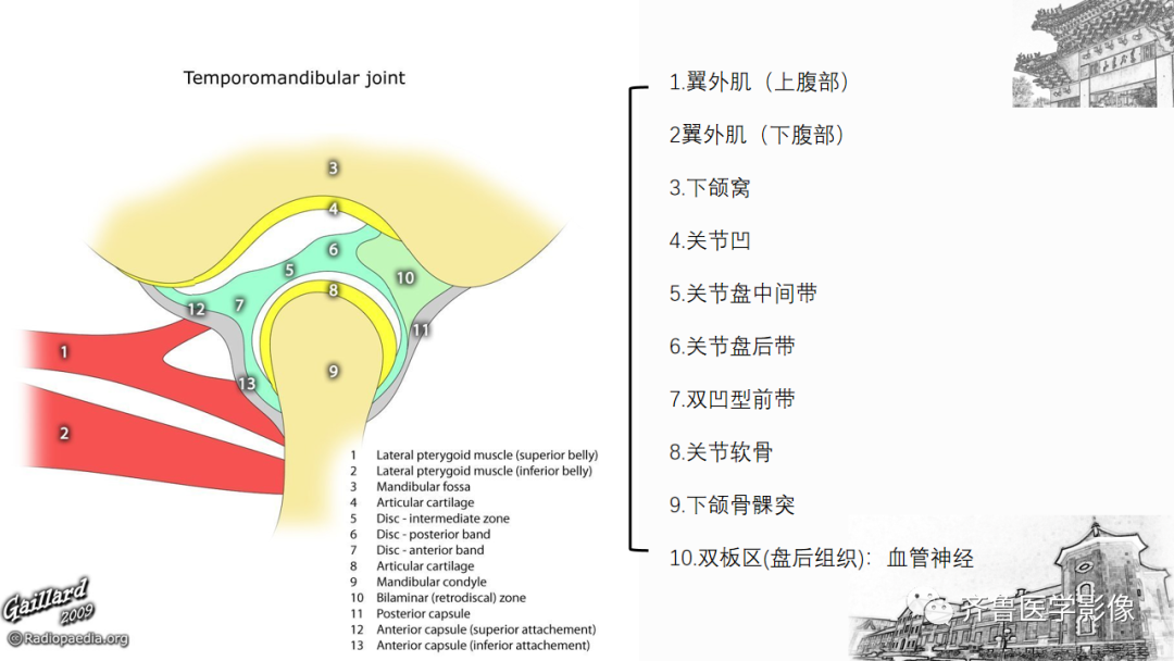 影像PPT - 【PPT】颞下颌关节紊乱-9