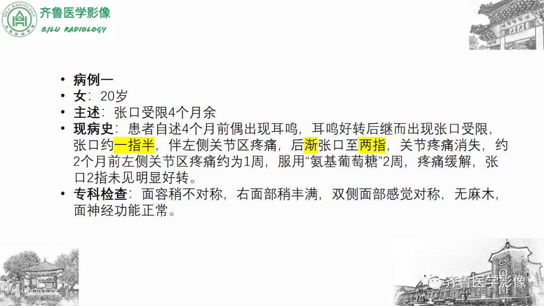 影像PPT - 【PPT】颞下颌关节紊乱-13