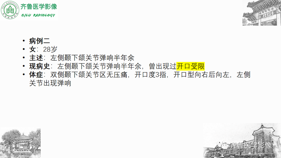 影像PPT - 【PPT】颞下颌关节紊乱-16