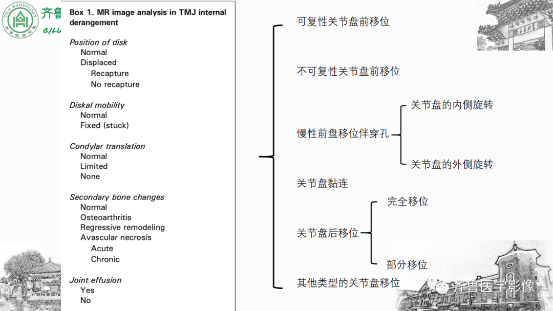 影像PPT - 【PPT】颞下颌关节紊乱-23