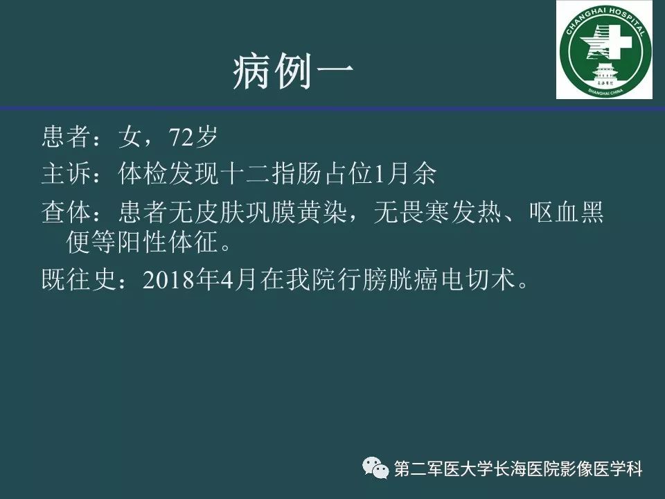影像PPT - 【PPT】常见的腹膜后占位诊断及鉴别诊断-2