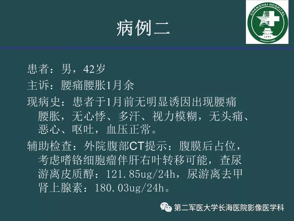 影像PPT - 【PPT】常见的腹膜后占位诊断及鉴别诊断-17