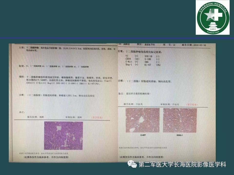 影像PPT - 【PPT】常见的腹膜后占位诊断及鉴别诊断-16