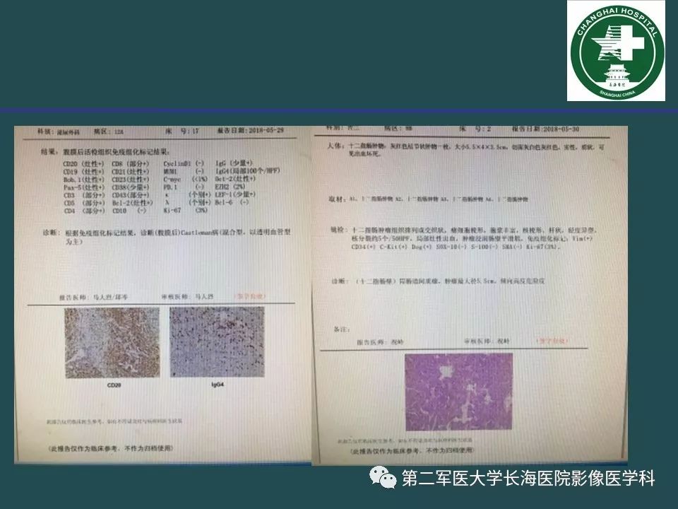 影像PPT - 【PPT】常见的腹膜后占位诊断及鉴别诊断-29