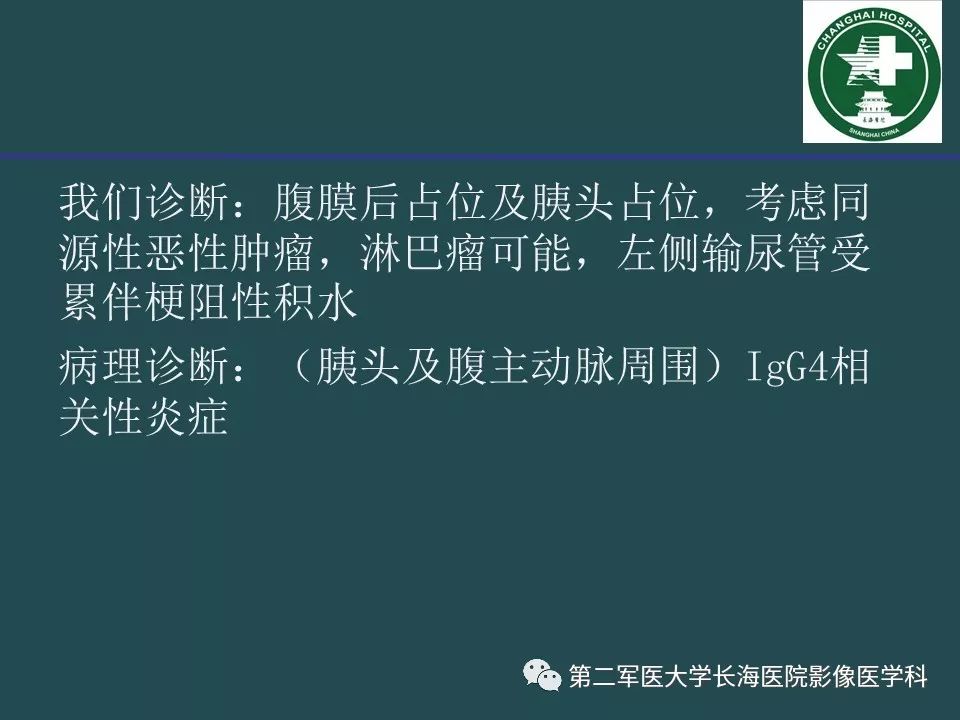 影像PPT - 【PPT】常见的腹膜后占位诊断及鉴别诊断-42