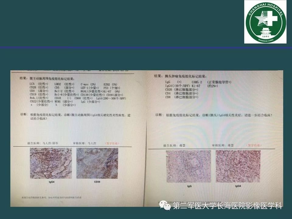 影像PPT - 【PPT】常见的腹膜后占位诊断及鉴别诊断-45
