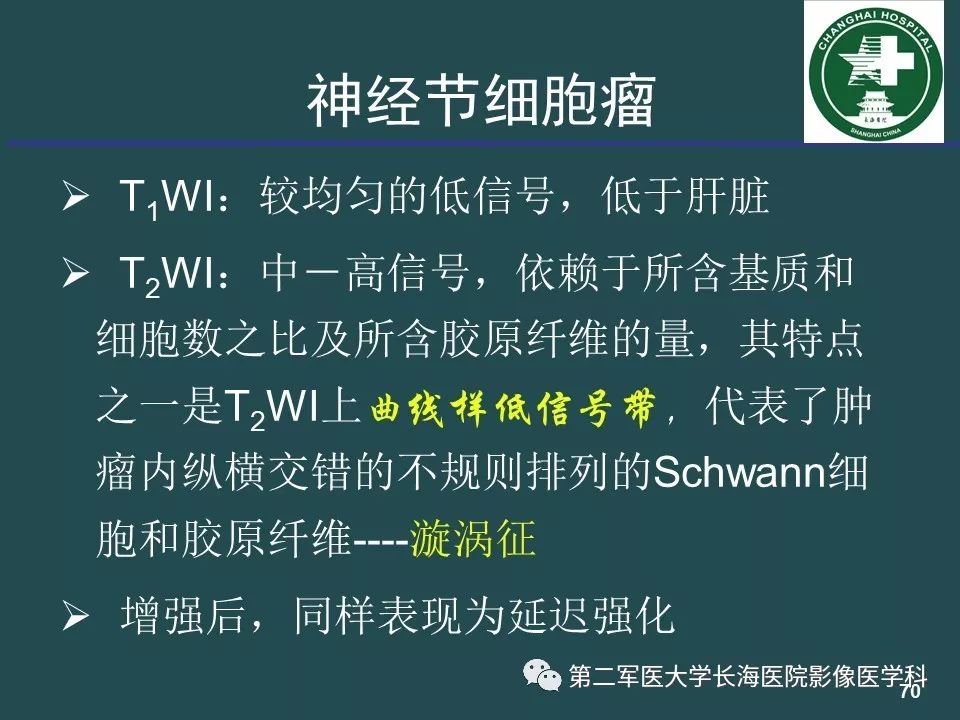 影像PPT - 【PPT】常见的腹膜后占位诊断及鉴别诊断-69