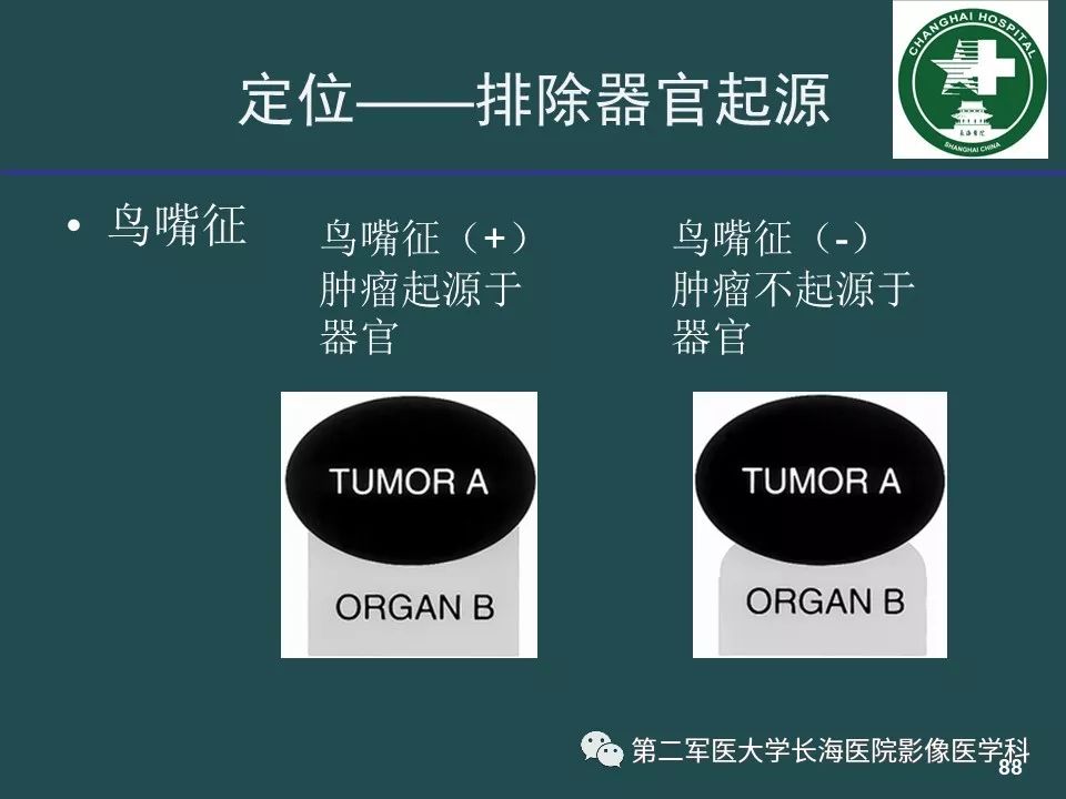 影像PPT - 【PPT】常见的腹膜后占位诊断及鉴别诊断-87