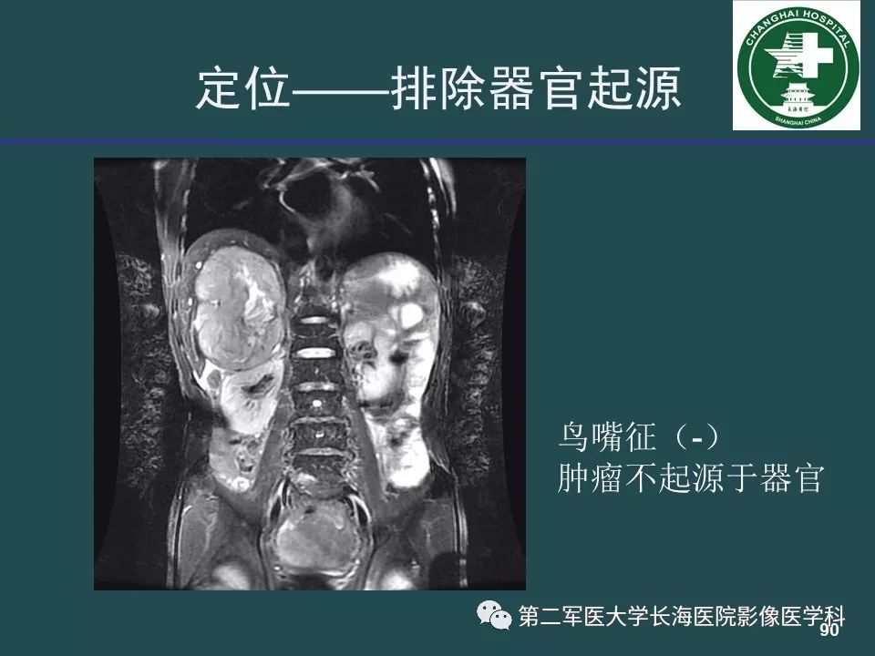 影像PPT - 【PPT】常见的腹膜后占位诊断及鉴别诊断-89