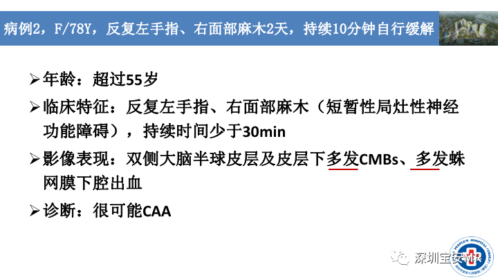影像PPT - 【PPT】淀粉样脑血管病的影像诊断-20