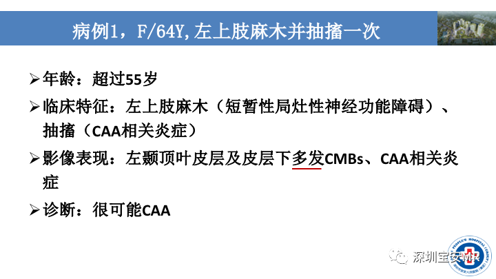 影像PPT - 【PPT】淀粉样脑血管病的影像诊断-19