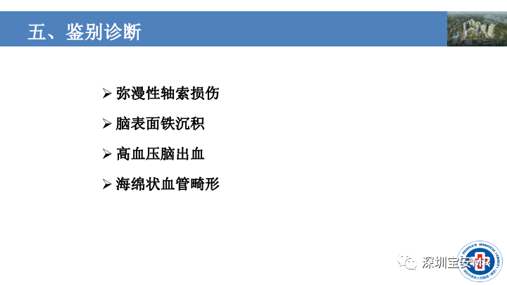 影像PPT - 【PPT】淀粉样脑血管病的影像诊断-30