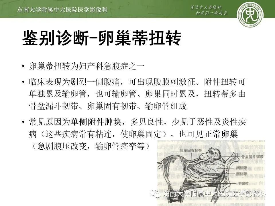 影像PPT - 【PPT】输卵管积脓-17