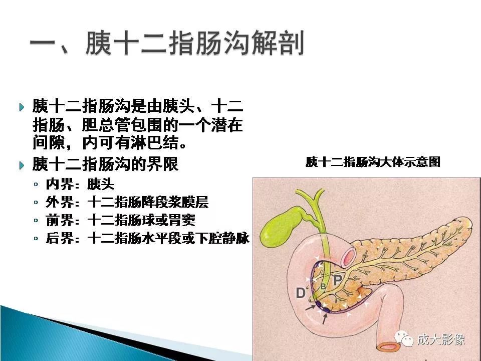 影像PPT - 【PPT】沟槽区胰腺炎的影像表现-2