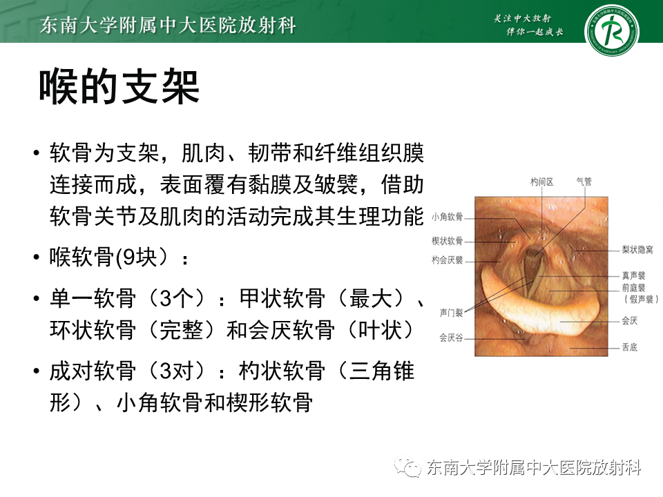 影像PPT - 【PPT】喉癌-5